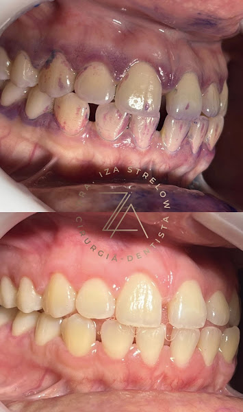 Foto 2 de Dra Iza Strelow - Dentista em Palhoça