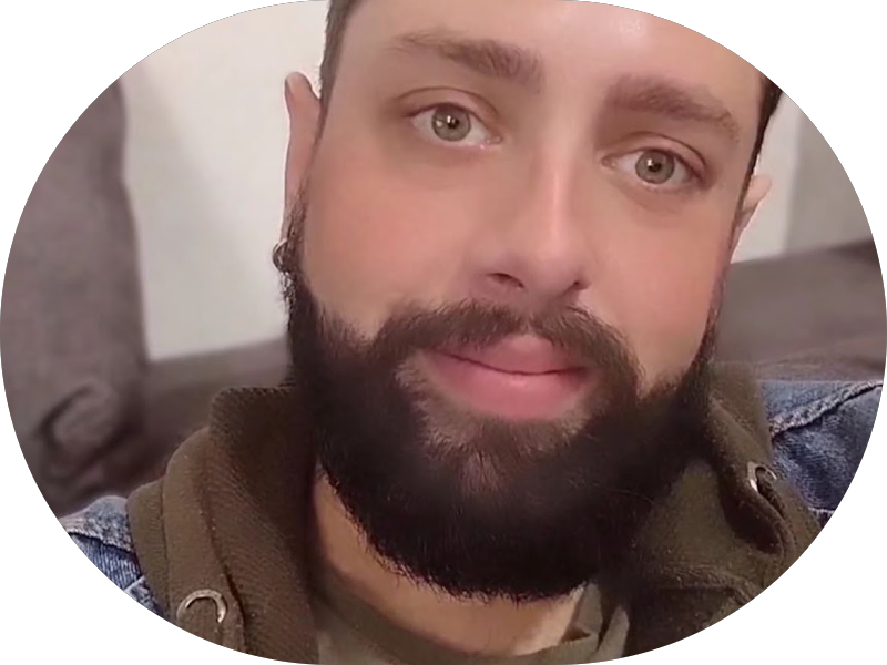 Foto 3 de Dra Izabella Lenzi | Lentes em Resina