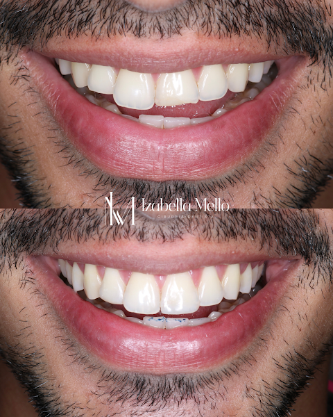 Foto 3 de Dra. Izabella Mello | Dentista em Natal | Urgência Odontológica 24h | Dentista 24h