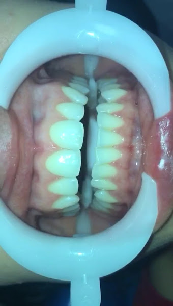 Foto 2 de Dra. Jackeline Gonçalves de Lima Odontologia