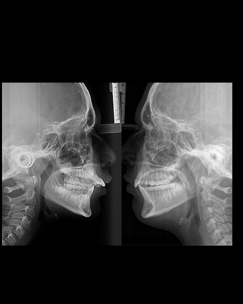 Foto 3 de Dra. Janaína Nunes, Ortodontista e Odontopediatra