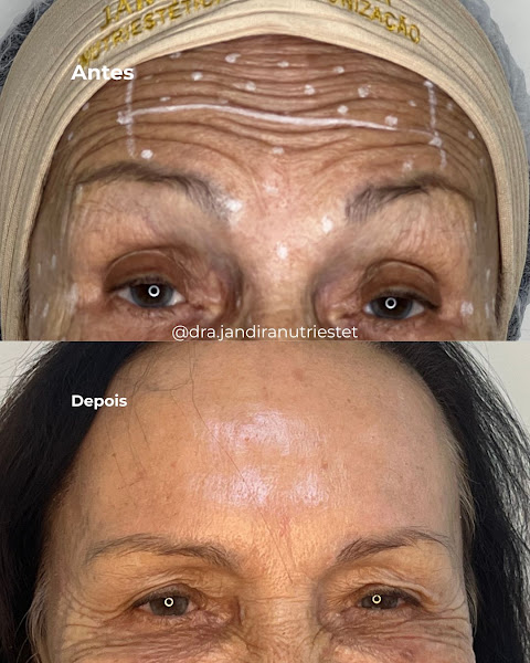 Foto 3 de Dra. Jandira Regina | Harmonização Orofacial e Nutrição