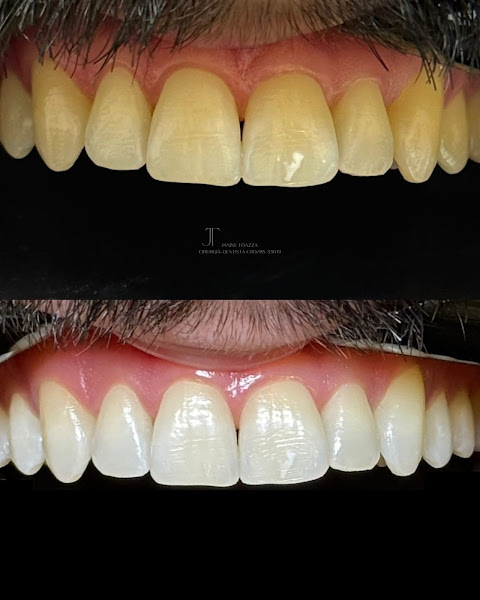 Foto 2 de Dra. Janine Toazza - Harmonização Orofacial e Odontologia Estética