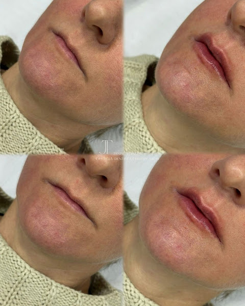 Foto 3 de Dra. Janine Toazza - Harmonização Orofacial e Odontologia Estética