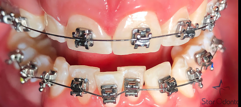 Foto 2 de Dra Jaqueline Moreira | Ortodontia | clínica geral | implantes | prótese