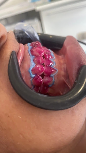 Foto 3 de Dra Jaqueline Moreira | Ortodontia | clínica geral | implantes | prótese