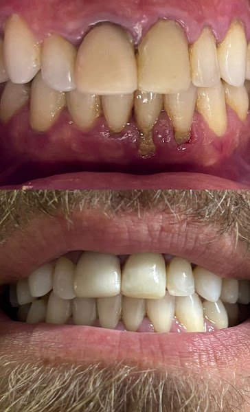 Foto 2 de Dra.Jaqueline Stumm - Cirurgiã Dentista