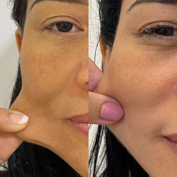 Foto 3 de Dra. Jeanne Gonzaga | Harmonização Facial