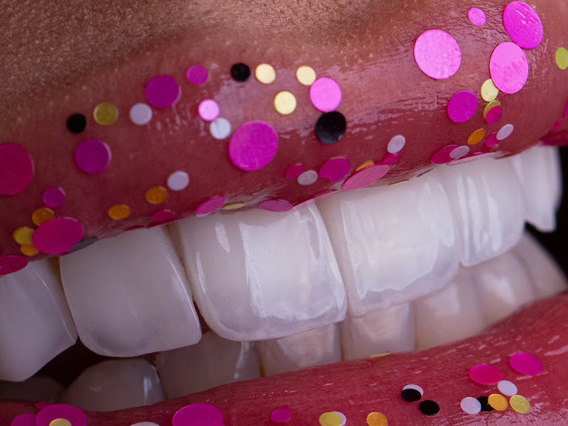 Foto 8 de Dra Jécica Schiochet - Dentista Joinville | Lentes em Resina