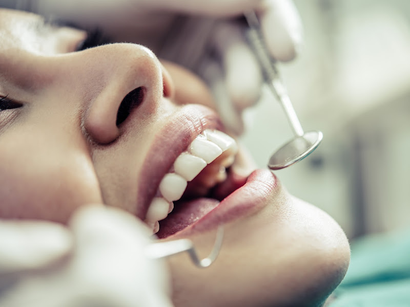 Foto 9 de Dra Jécica Schiochet - Dentista Joinville | Lentes em Resina