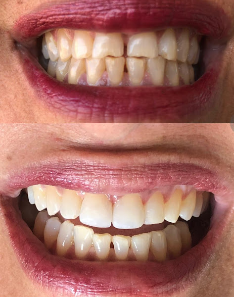 Foto 3 de Dra. Jena Feres | Dentista em São Luís | Tratamento de canal | Facetas de resina | Clareamento dental