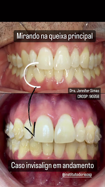 Foto 4 de Dra. Jennifer Simão - JOS - Odontologia
