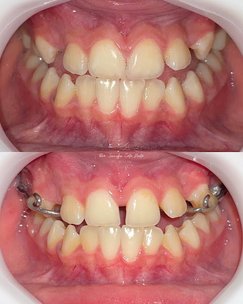 Foto 2 de Dra. Jennyfer Cata Preta | Dentista