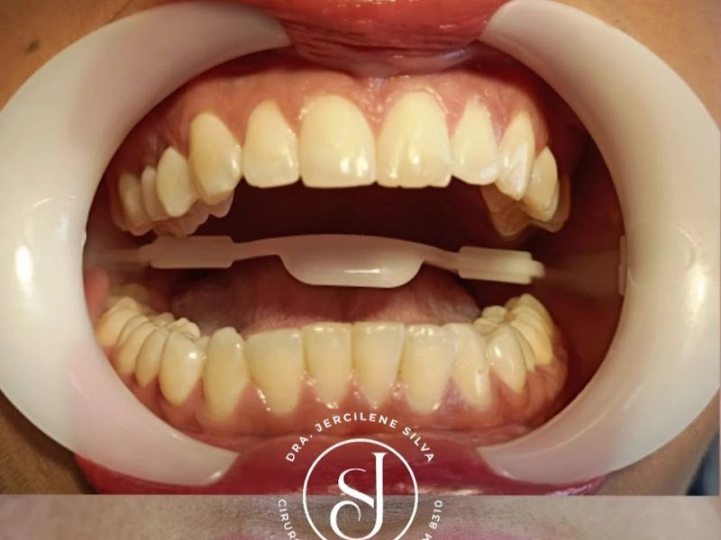 Foto de Dra. Jercilene Silva - Clínica Odontológica