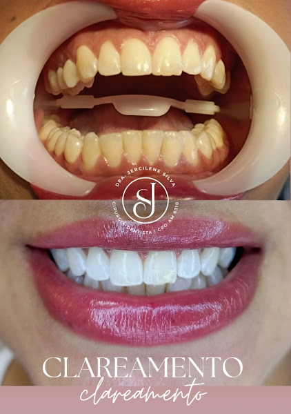 Foto 2 de Dra. Jercilene Silva - Clínica Odontológica