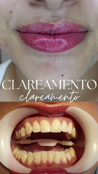 Foto 3 de Dra. Jercilene Silva - Clínica Odontológica