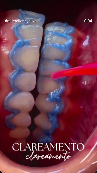 Foto 4 de Dra. Jercilene Silva - Clínica Odontológica