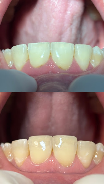 Foto 2 de Dra. Jéssica Arielli Pradelli - Dentista - Endodontista
