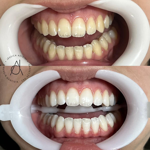 Foto 2 de Dra. Jéssica Astrisi | Cirurgiã - Dentista