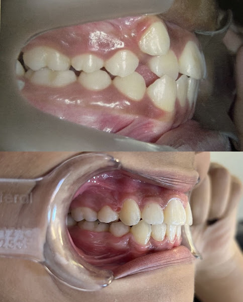 Foto 3 de Dra Jessica Ayme Barros - Dentista Juazeiro do norte