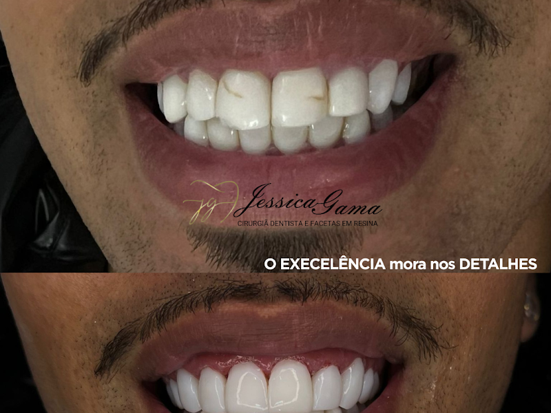 Foto 3 de Dra. Jessica F. Silva - Harmonização Orofacial e Cirurgia Estética da Face