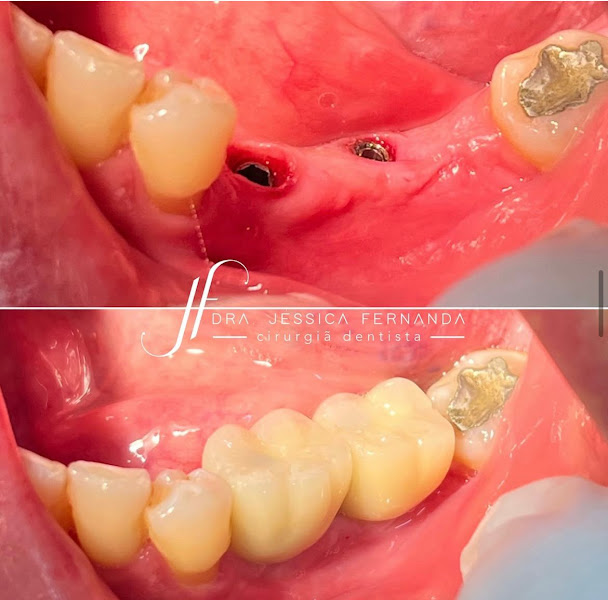 Foto 3 de Dra. Jéssica Fernanda | Odontologia Estética e Implantes | Dentista Rio Preto 24 hrs