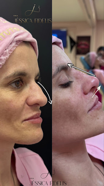 Foto 2 de Dra. Jéssica Fidelis Harmonização Facial e Ortodontia