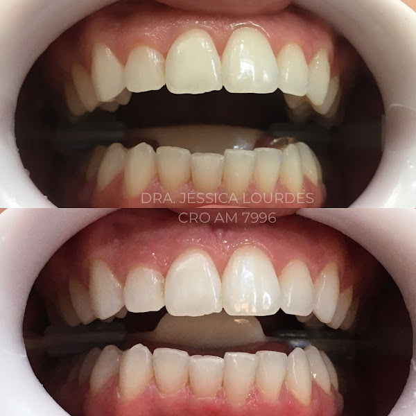 Foto 2 de Dra. Jessica Lourdes, Dentista