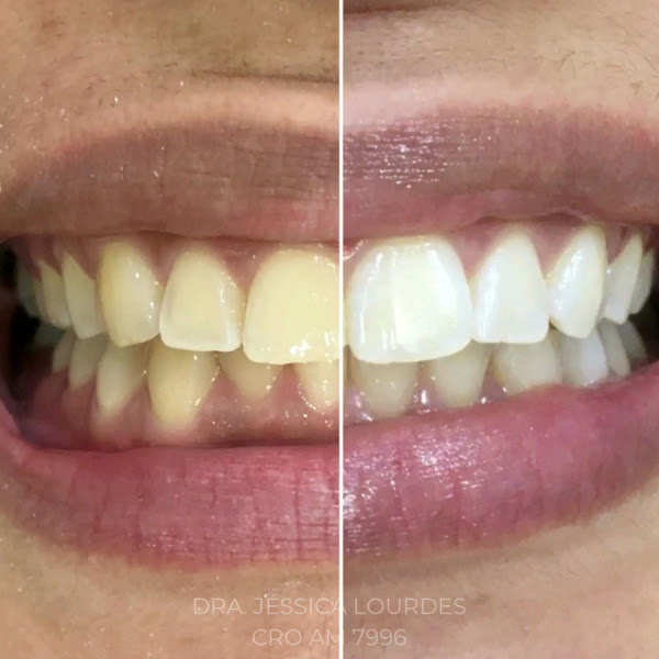 Foto 3 de Dra. Jessica Lourdes, Dentista