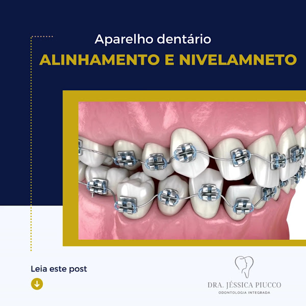 Foto 2 de Dra. Jéssica Piucco Odontologia Especializada