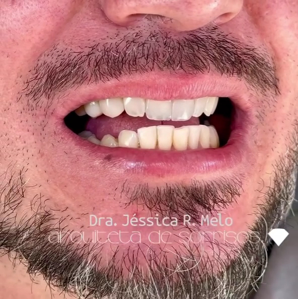 Foto 4 de Dra. Jessica R. Melo - Arquiteta de Sorrisos