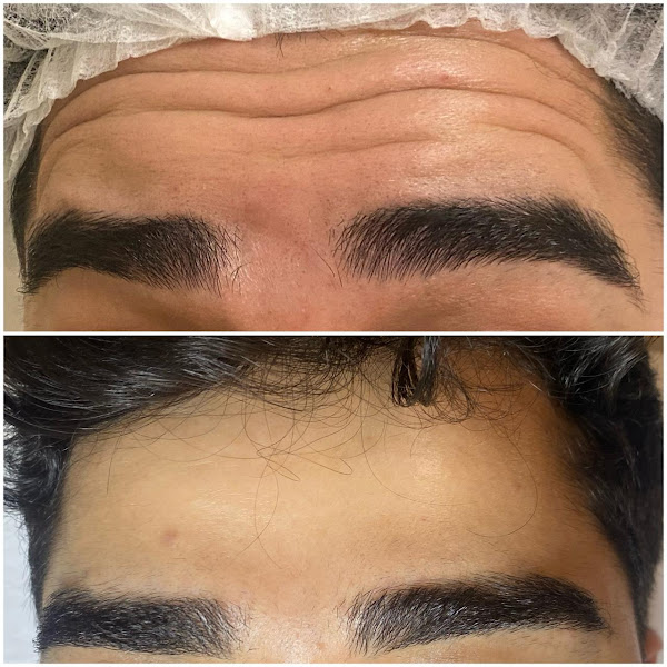 Foto 3 de Dra Jéssica Sena - Estética e Harmonização (face e corpo)