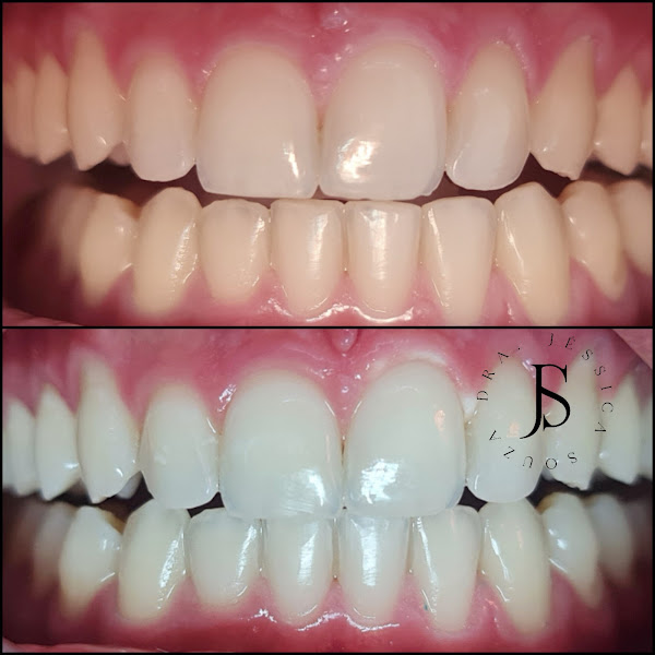 Foto 2 de Dra. Jéssica Souza Odontologia Especializada