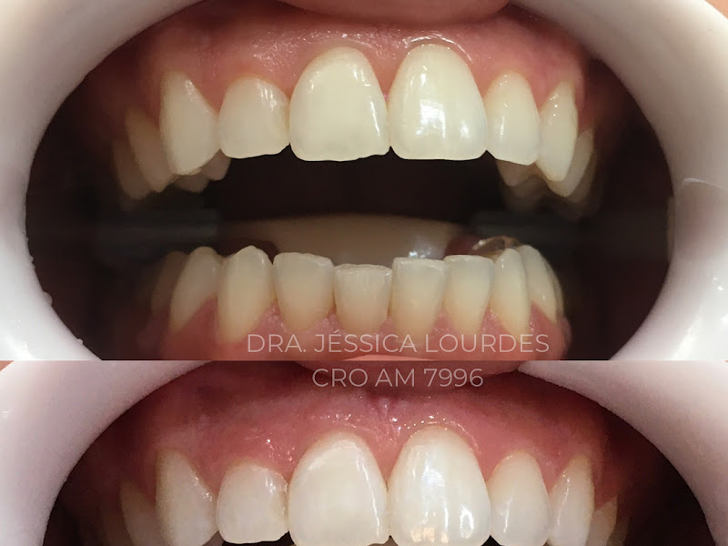 Foto 7 de Dra. Jéssica Vasconcelos | Dentista, Ortodontia Manaus