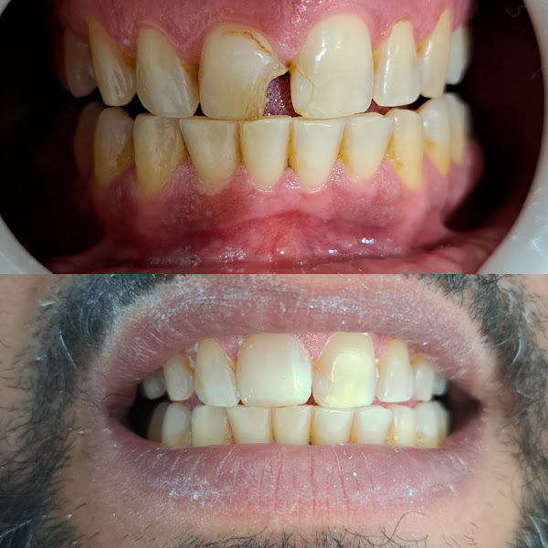 Foto 2 de Dra. Joana Dokko - Odontologia e Estética integrada