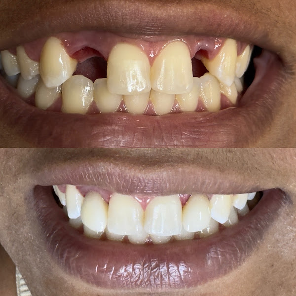 Foto 3 de Dra Joana Ferreira | Dentista 24 horas