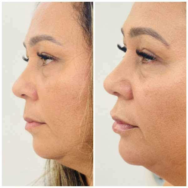 Foto 3 de DRA. Joelma Oliveira Steticlinic