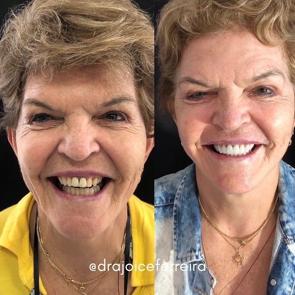Foto 3 de Dra Joice Ferreira