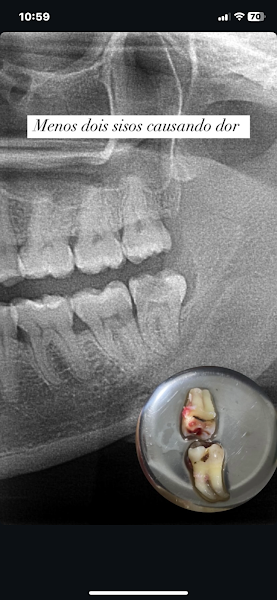 Foto 4 de Dra. Joicy Erlis - Dentista 24h