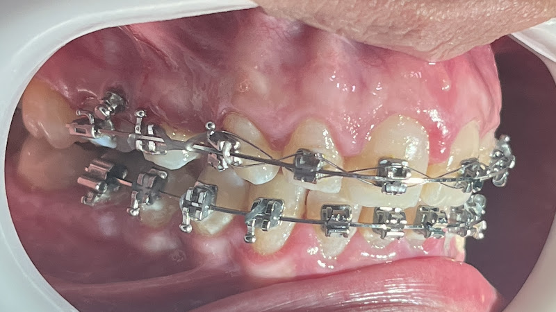 Foto 2 de Dra Jomara Paola | Ortodontia | Vila Isabel