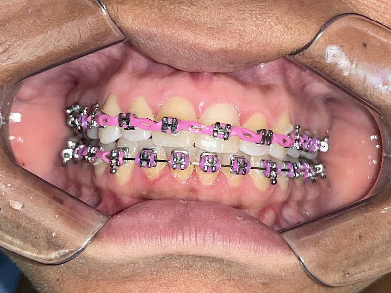 Foto 3 de Dra Jomara Paola | Ortodontia | Vila Isabel