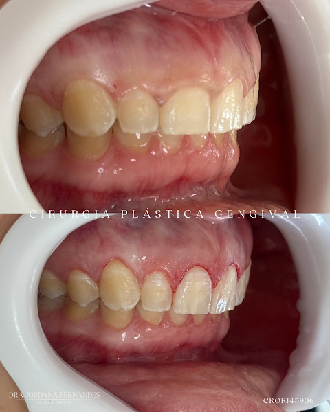 Foto 3 de Dra Jordana Fernandes Cirurgiã-dentista