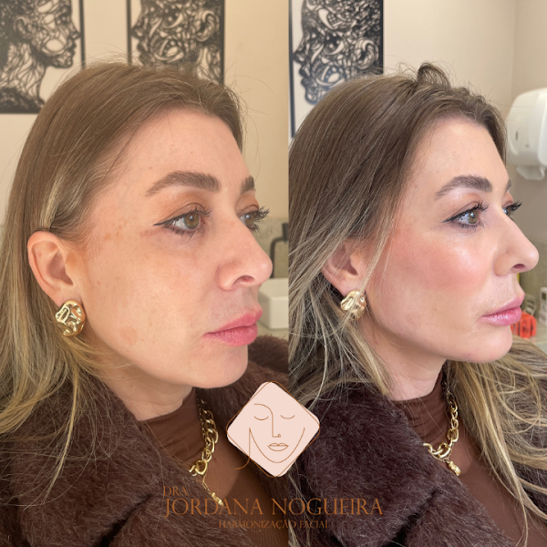 Foto 3 de Dra Jordana Nogueira