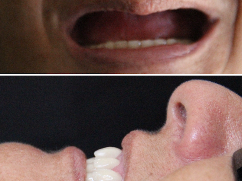 Foto 8 de Dra. Joyce Bernardo - BEJOY ODONTOLOGIA