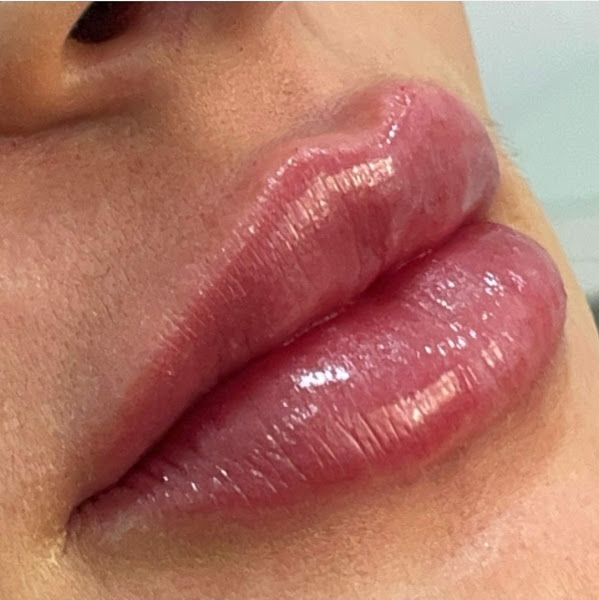 Foto 2 de Dra. Joyce Bravo