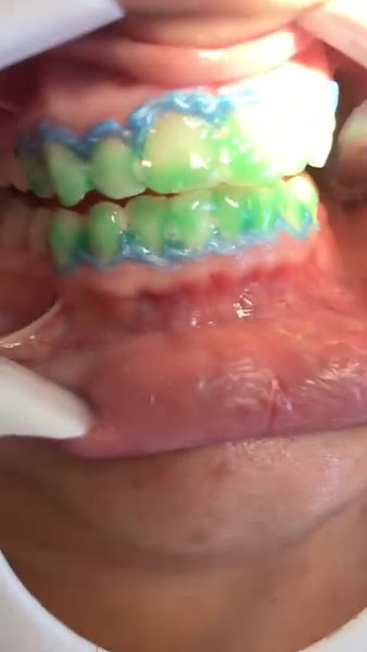 Foto 4 de Dra. Joyce Calil - Dentista Emergência 24 horas