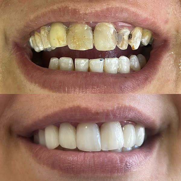 Foto 3 de Dra Joyce Pessoa Odontologia Integrada