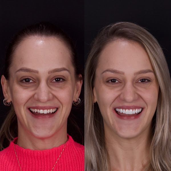 Foto 2 de Dra Jucieli Signor | Ortodontia: aparelhos fixos adulto e infantil. Implantes dentários. Tratamento de canal. Clínica Geral