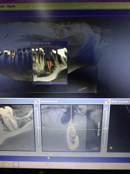 Foto 2 de Dra Juhama Beatriz de Souza Dentista