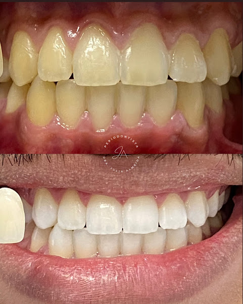 Foto 2 de Dra. Julia Almeida | Periodontia e Reabilitação Oral Estética